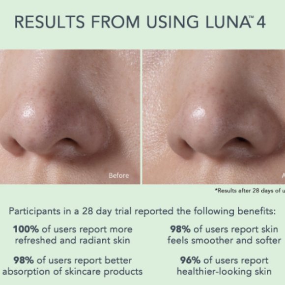 Foreo Luna 4 - Smart cleansing and firming device - Combination Skin -  MINT - Picture 2 of 3